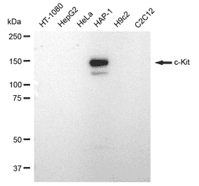 Western Blot - Anti-c-KIT Antibody [23GB2225] (A344128) - Antibodies.com