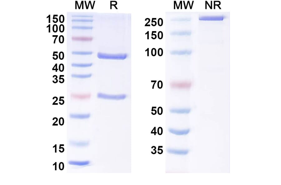SDS-PAGE - Anti-Tau Antibody [DC8E8] - BSA and Azide free (A344145) - Antibodies.com