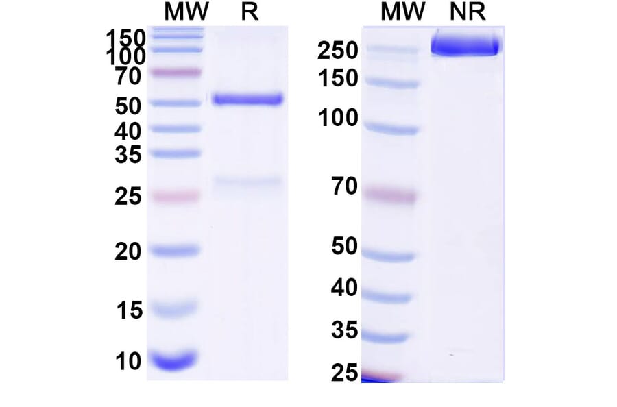 SDS-PAGE - Anti-RBP2b Antibody [SAA2534] - BSA and Azide free (A344149) - Antibodies.com