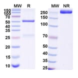 SDS-PAGE - Anti-RBP2b Antibody [SAA2534] - BSA and Azide free (A344149) - Antibodies.com