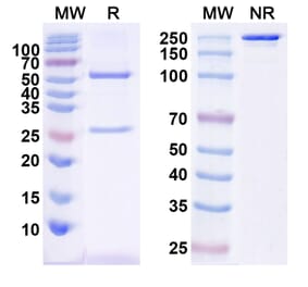 SDS-PAGE - Anti-CTGF Antibody [Research Grade] [Iv0075] - BSA and Azide free (A344156) - Antibodies.com