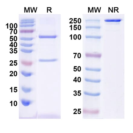 SDS-PAGE - Anti-CTGF Antibody [Research Grade] [Iv0075] - BSA and Azide free (A344156) - Antibodies.com