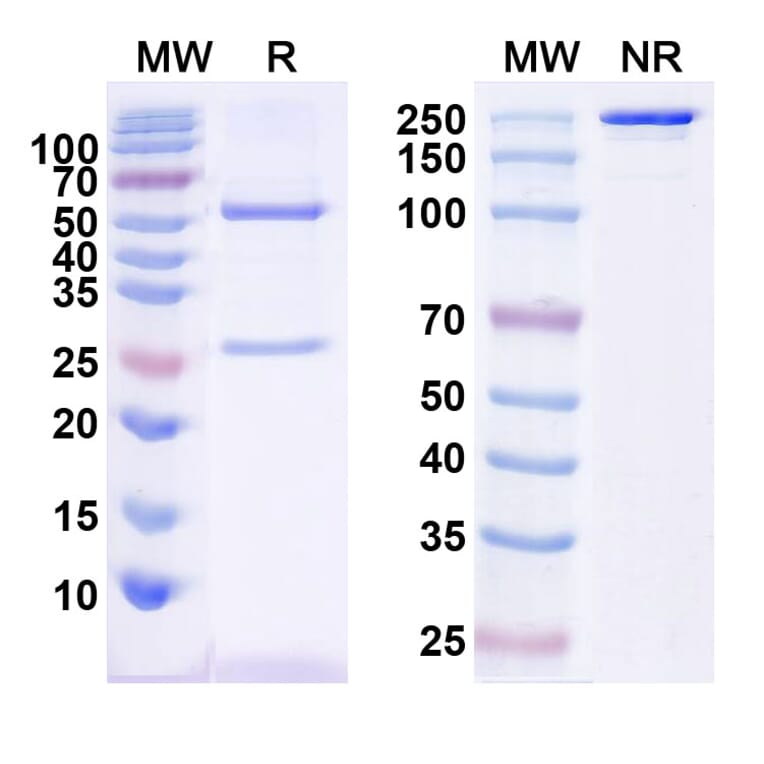 SDS-PAGE - Anti-CTGF Antibody [Research Grade] [Iv0075] - BSA and Azide free (A344156) - Antibodies.com