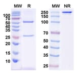 SDS-PAGE - Anti-CTGF Antibody [Research Grade] [Iv0075] - BSA and Azide free (A344156) - Antibodies.com