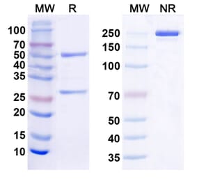 SDS-PAGE - Anti-TREM2 Antibody [Research Grade] [EOS006215] - BSA and Azide free (A344159) - Antibodies.com
