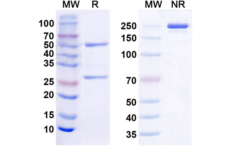 SDS-PAGE - Anti-TREM2 Antibody [Research Grade] [EOS006215] - BSA and Azide free (A344159) - Antibodies.com