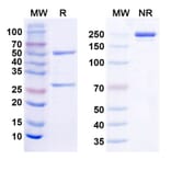 SDS-PAGE - Anti-TREM2 Antibody [Research Grade] [EOS006215] - BSA and Azide free (A344159) - Antibodies.com