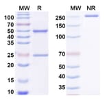 SDS-PAGE - Anti-NGF Antibody [MEDI578] - BSA and Azide free (A344162) - Antibodies.com