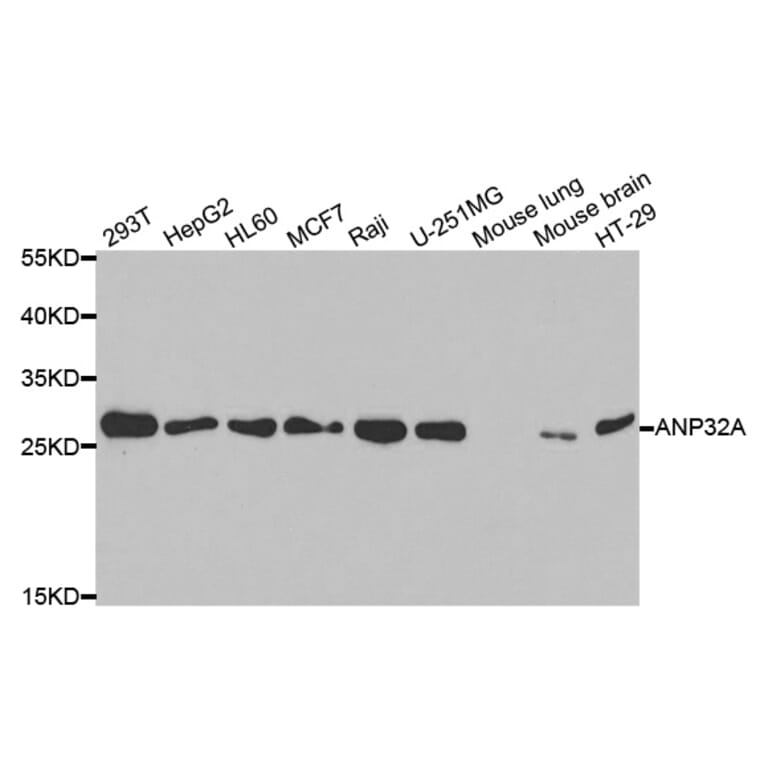 Western blot - ANP32A Antibody from Signalway Antibody (33030) - Antibodies.com