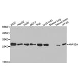 Western blot - ANP32A Antibody from Signalway Antibody (33030) - Antibodies.com