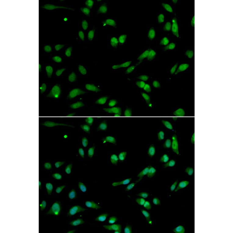 Immunofluorescence - ANP32A Antibody from Signalway Antibody (33030) - Antibodies.com