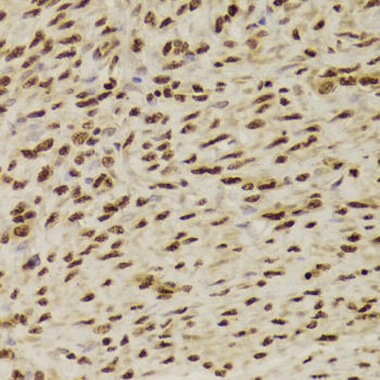 Immunohistochemistry - ANP32A Antibody from Signalway Antibody (33030) - Antibodies.com