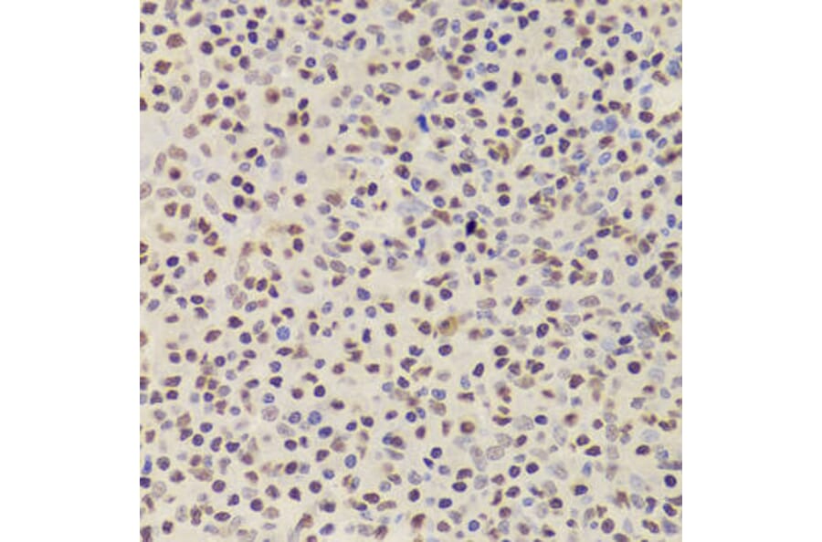 Immunohistochemistry - ANP32A Antibody from Signalway Antibody (33030) - Antibodies.com