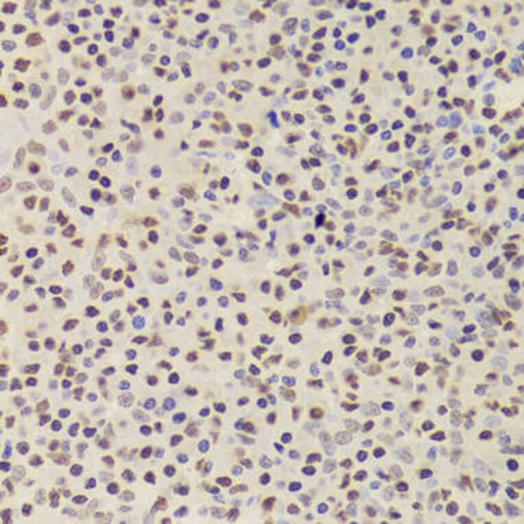 Immunohistochemistry - ANP32A Antibody from Signalway Antibody (33030) - Antibodies.com
