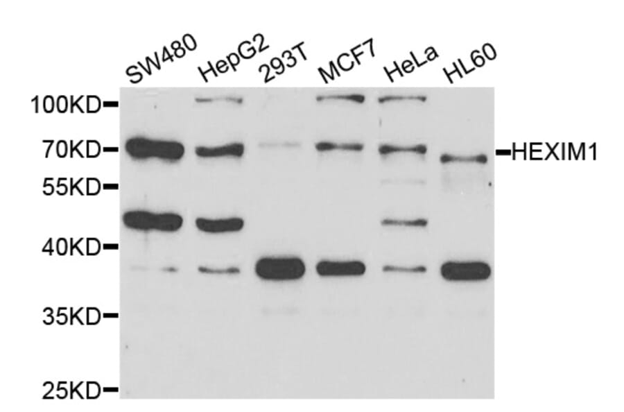 Western blot - HEXIM1 Antibody from Signalway Antibody (33037) - Antibodies.com