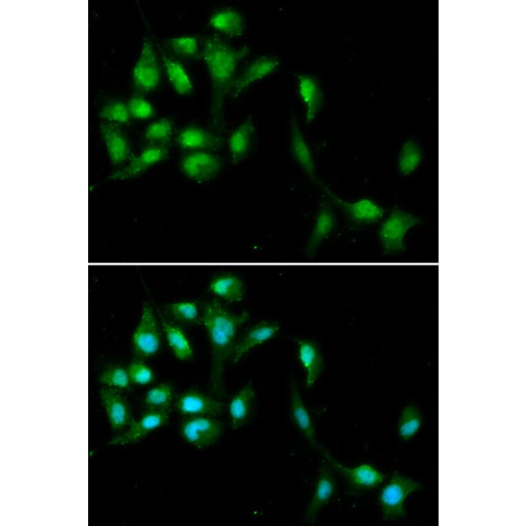 Immunofluorescence - HEXIM1 Antibody from Signalway Antibody (33037) - Antibodies.com