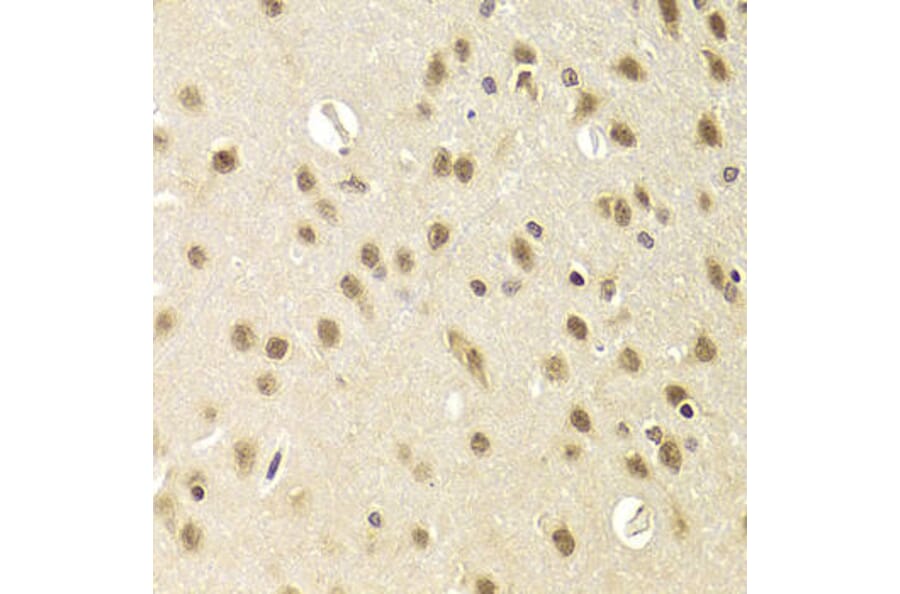 Immunohistochemistry - HEXIM1 Antibody from Signalway Antibody (33037) - Antibodies.com