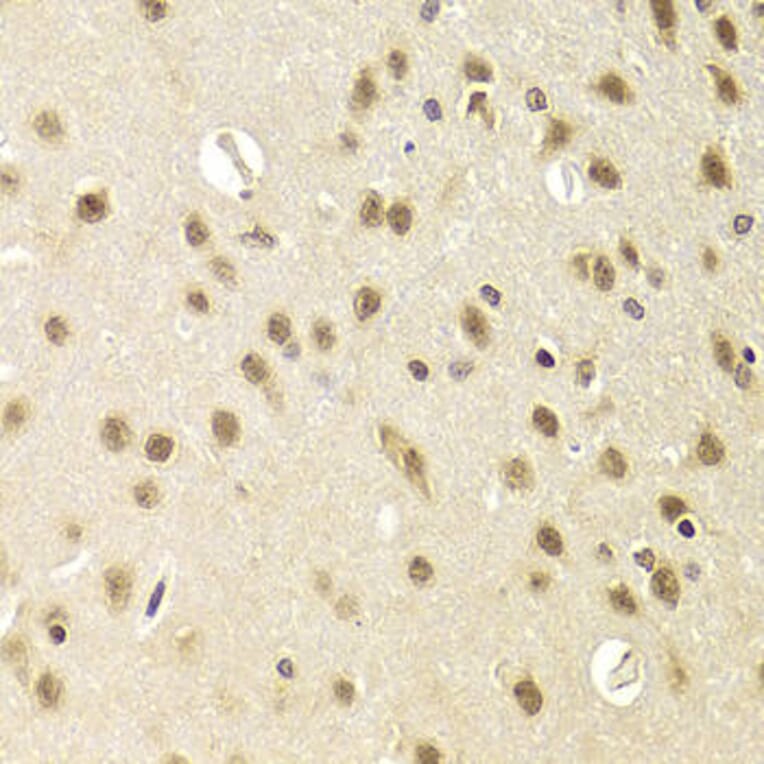 Immunohistochemistry - HEXIM1 Antibody from Signalway Antibody (33037) - Antibodies.com