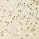 Immunohistochemistry - HEXIM1 Antibody from Signalway Antibody (33037) - Antibodies.com