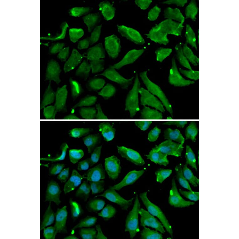 Immunofluorescence - NFKBIB Antibody from Signalway Antibody (33039) - Antibodies.com