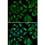 Immunofluorescence - NFKBIB Antibody from Signalway Antibody (33039) - Antibodies.com