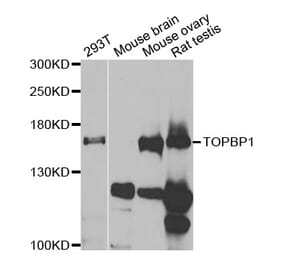Western blot - TOPBP1 Antibody from Signalway Antibody (33043) - Antibodies.com
