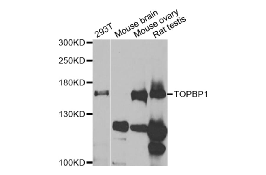 Western blot - TOPBP1 Antibody from Signalway Antibody (33043) - Antibodies.com