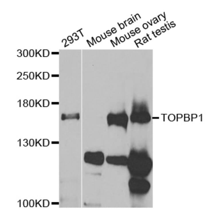 Western blot - TOPBP1 Antibody from Signalway Antibody (33043) - Antibodies.com