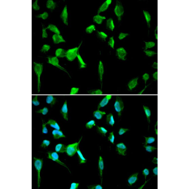 Immunofluorescence - TOPBP1 Antibody from Signalway Antibody (33043) - Antibodies.com