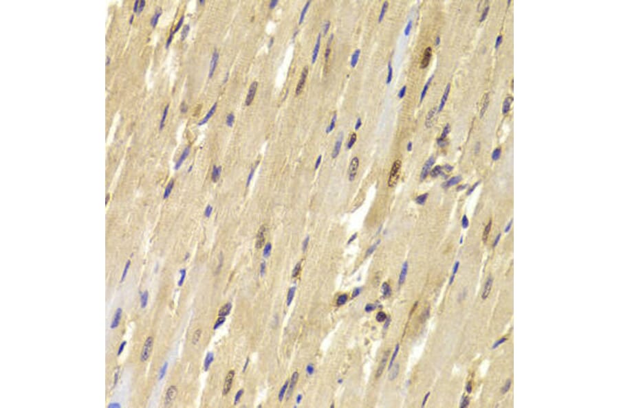 Immunohistochemistry - TOPBP1 Antibody from Signalway Antibody (33043) - Antibodies.com