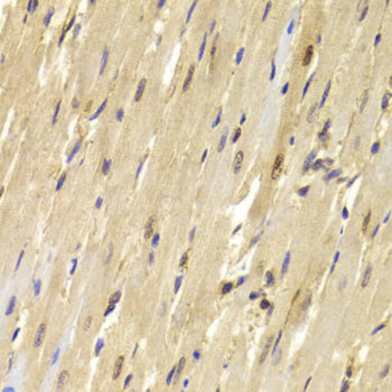 Immunohistochemistry - TOPBP1 Antibody from Signalway Antibody (33043) - Antibodies.com