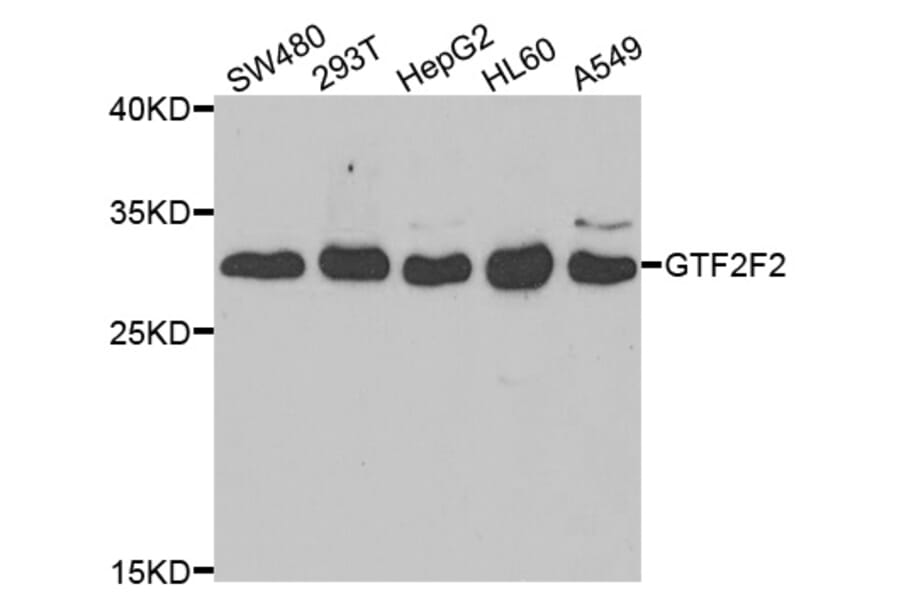 Western blot - GTF2F2 Antibody from Signalway Antibody (33071) - Antibodies.com