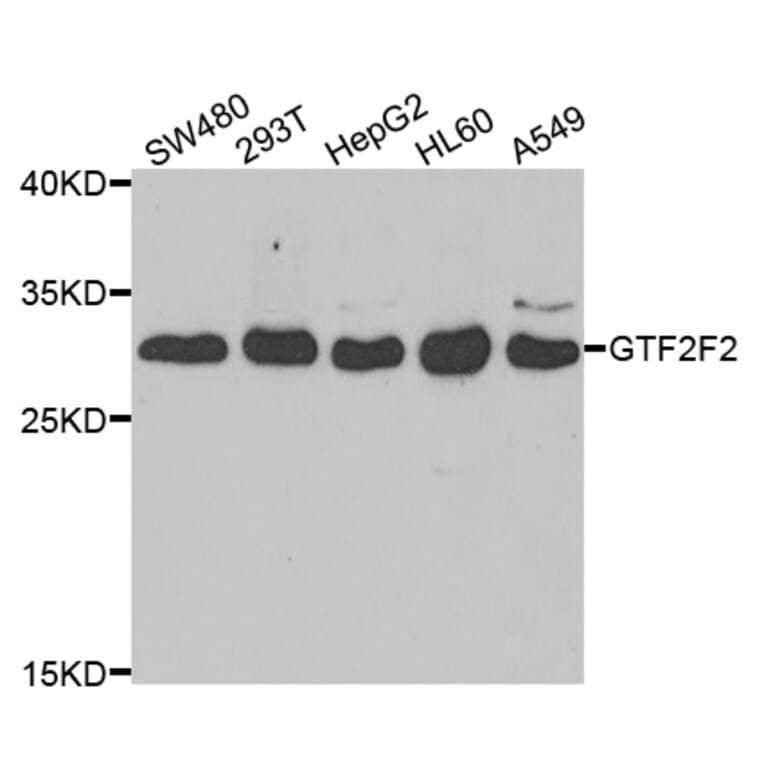 Western blot - GTF2F2 Antibody from Signalway Antibody (33071) - Antibodies.com