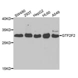 Western blot - GTF2F2 Antibody from Signalway Antibody (33071) - Antibodies.com