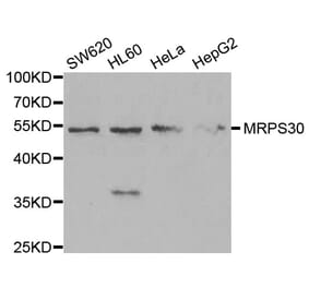 Western blot - MRPS30 Antibody from Signalway Antibody (33080) - Antibodies.com