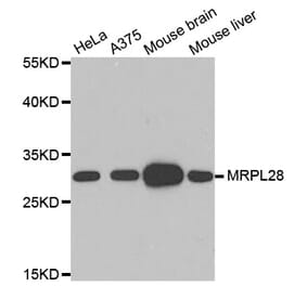 Western blot - MRPL28 Antibody from Signalway Antibody (33103) - Antibodies.com