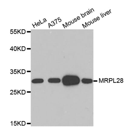 Western blot - MRPL28 Antibody from Signalway Antibody (33103) - Antibodies.com