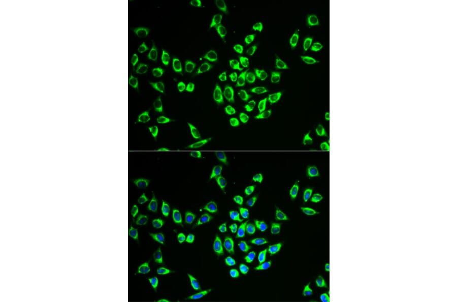 Immunofluorescence - MRPL28 Antibody from Signalway Antibody (33103) - Antibodies.com