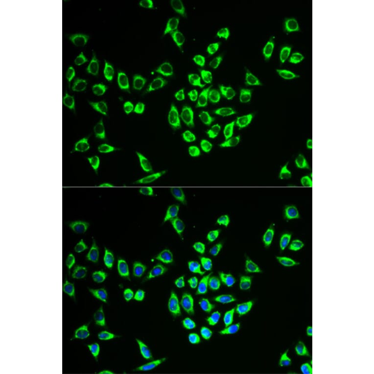 Immunofluorescence - MRPL28 Antibody from Signalway Antibody (33103) - Antibodies.com