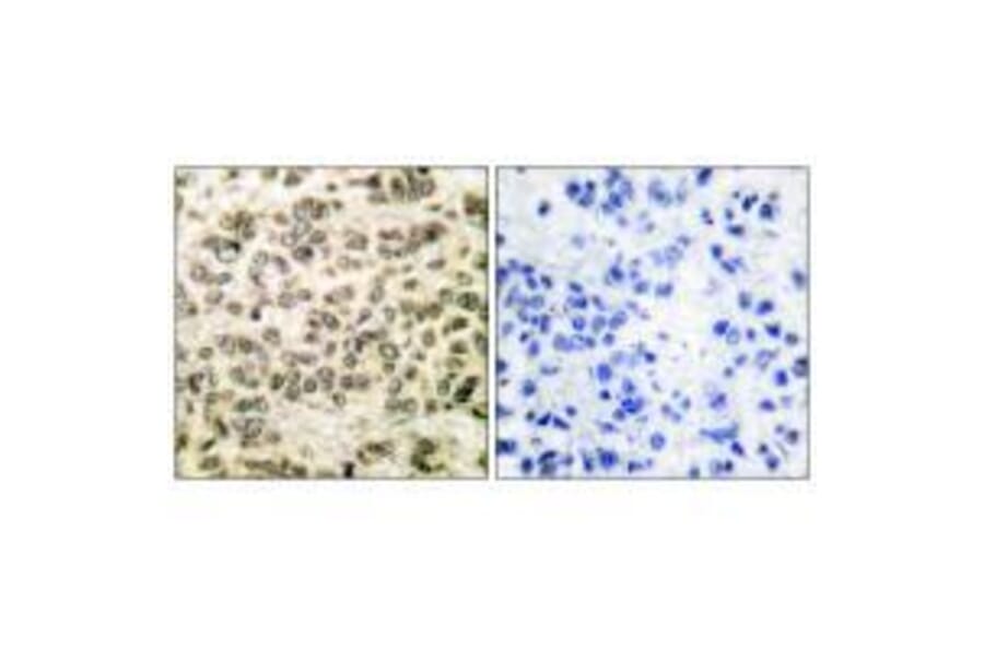 Immunohistochemistry - HDAC3 Antibody from Signalway Antibody (33400) - Antibodies.com