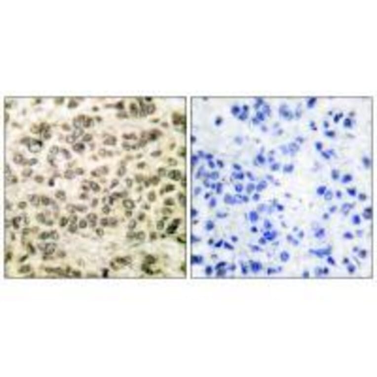 Immunohistochemistry - HDAC3 Antibody from Signalway Antibody (33400) - Antibodies.com