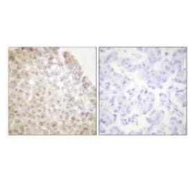 Immunohistochemistry - HDAC5 Antibody from Signalway Antibody (33401) - Antibodies.com