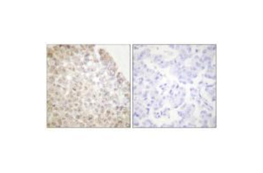 Immunohistochemistry - HDAC5 Antibody from Signalway Antibody (33401) - Antibodies.com