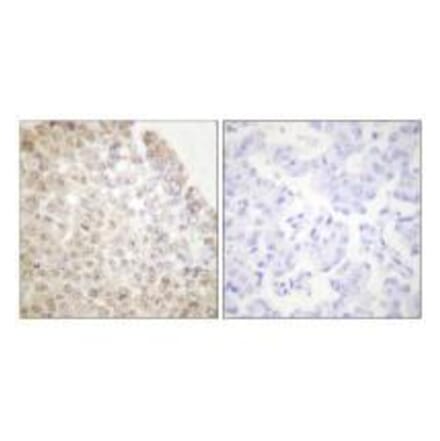 Immunohistochemistry - HDAC5 Antibody from Signalway Antibody (33401) - Antibodies.com