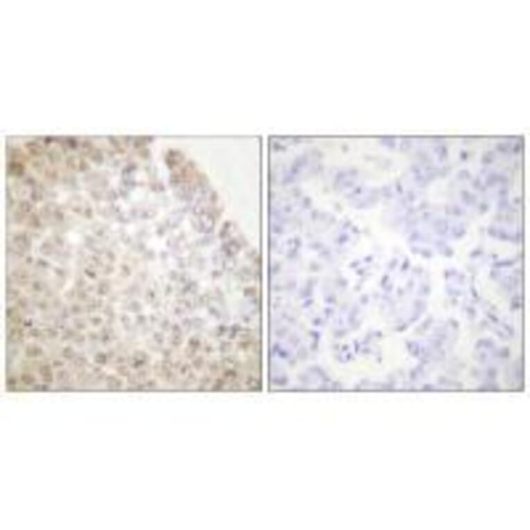 Immunohistochemistry - HDAC5 Antibody from Signalway Antibody (33401) - Antibodies.com