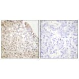Immunohistochemistry - HDAC5 Antibody from Signalway Antibody (33401) - Antibodies.com