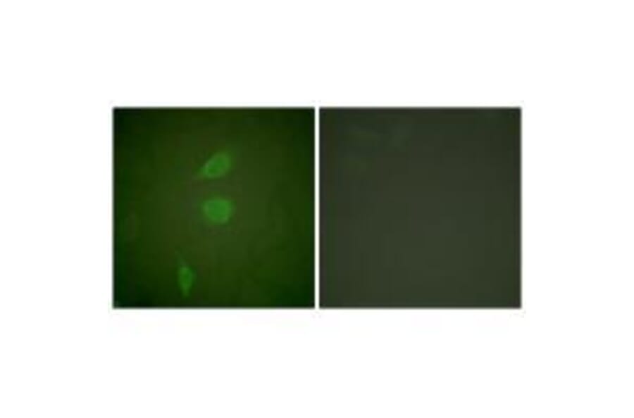 Immunofluorescence - HDAC5 Antibody from Signalway Antibody (33401) - Antibodies.com