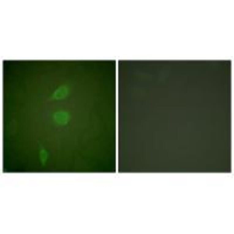 Immunofluorescence - HDAC5 Antibody from Signalway Antibody (33401) - Antibodies.com