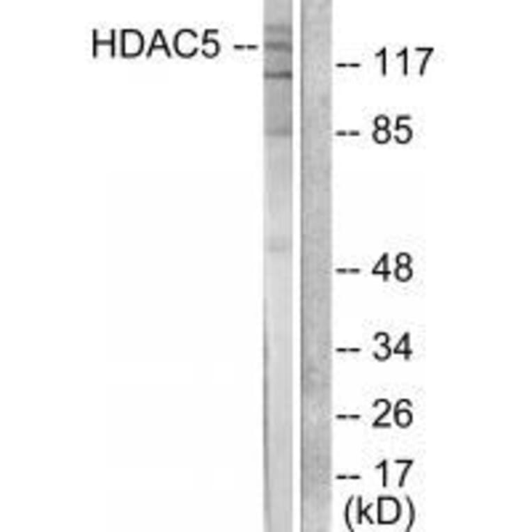 Western blot - HDAC5 Antibody from Signalway Antibody (33401) - Antibodies.com