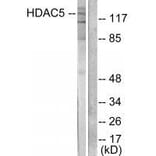 Western blot - HDAC5 Antibody from Signalway Antibody (33401) - Antibodies.com